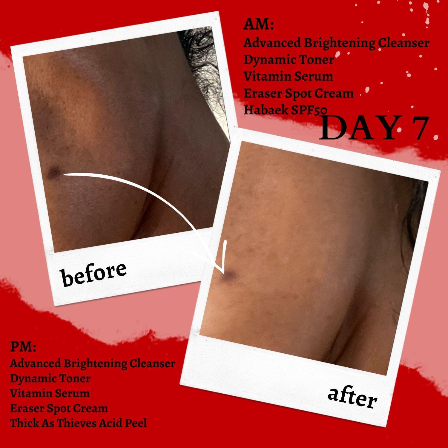 Thick As Thieves Pure Glycolic Acid Lactic Acid Extreme Gel Peel - 30ml