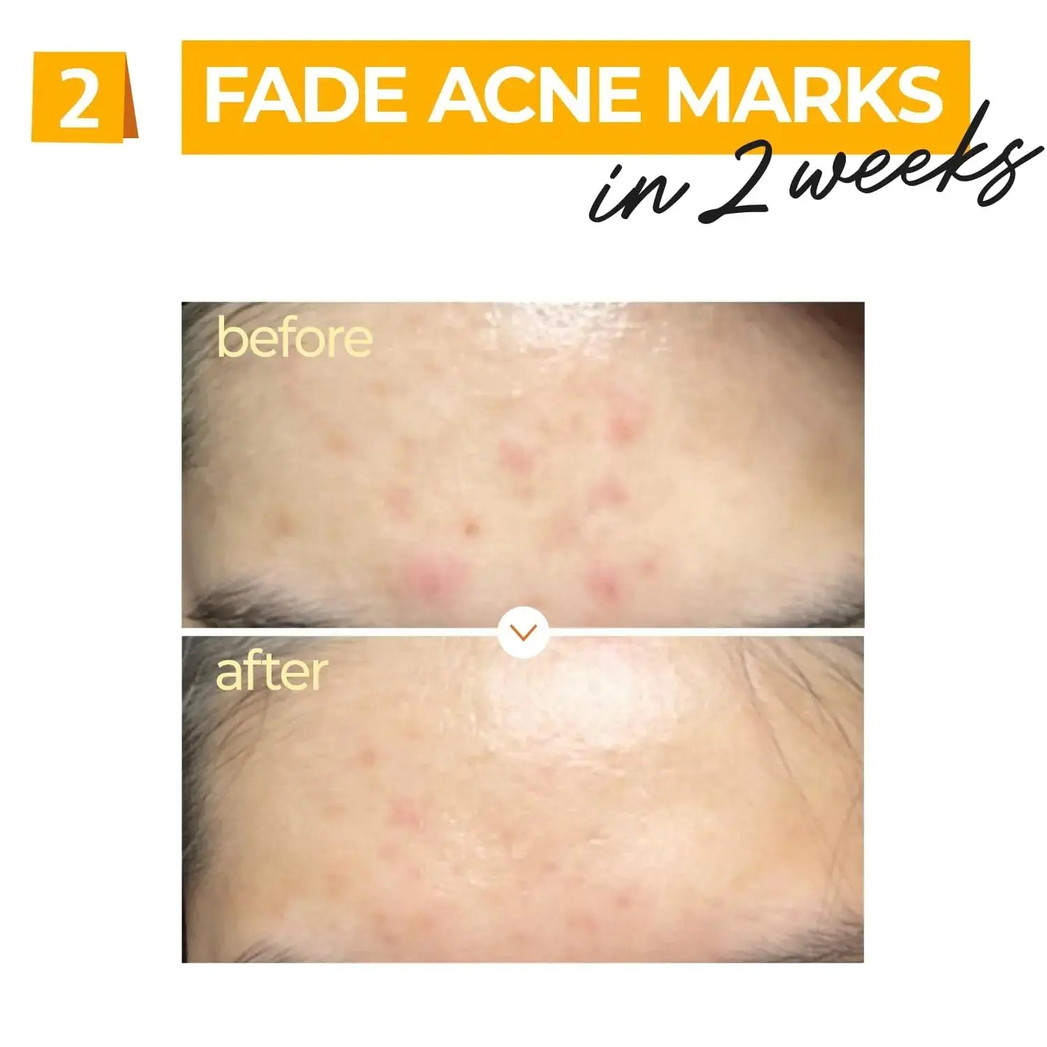 Numbuzin No.5+ Vitamin Concentrated Serum | Glutathione & Vitamin Serum, Radiant Skin, Korean Skin Care for Face